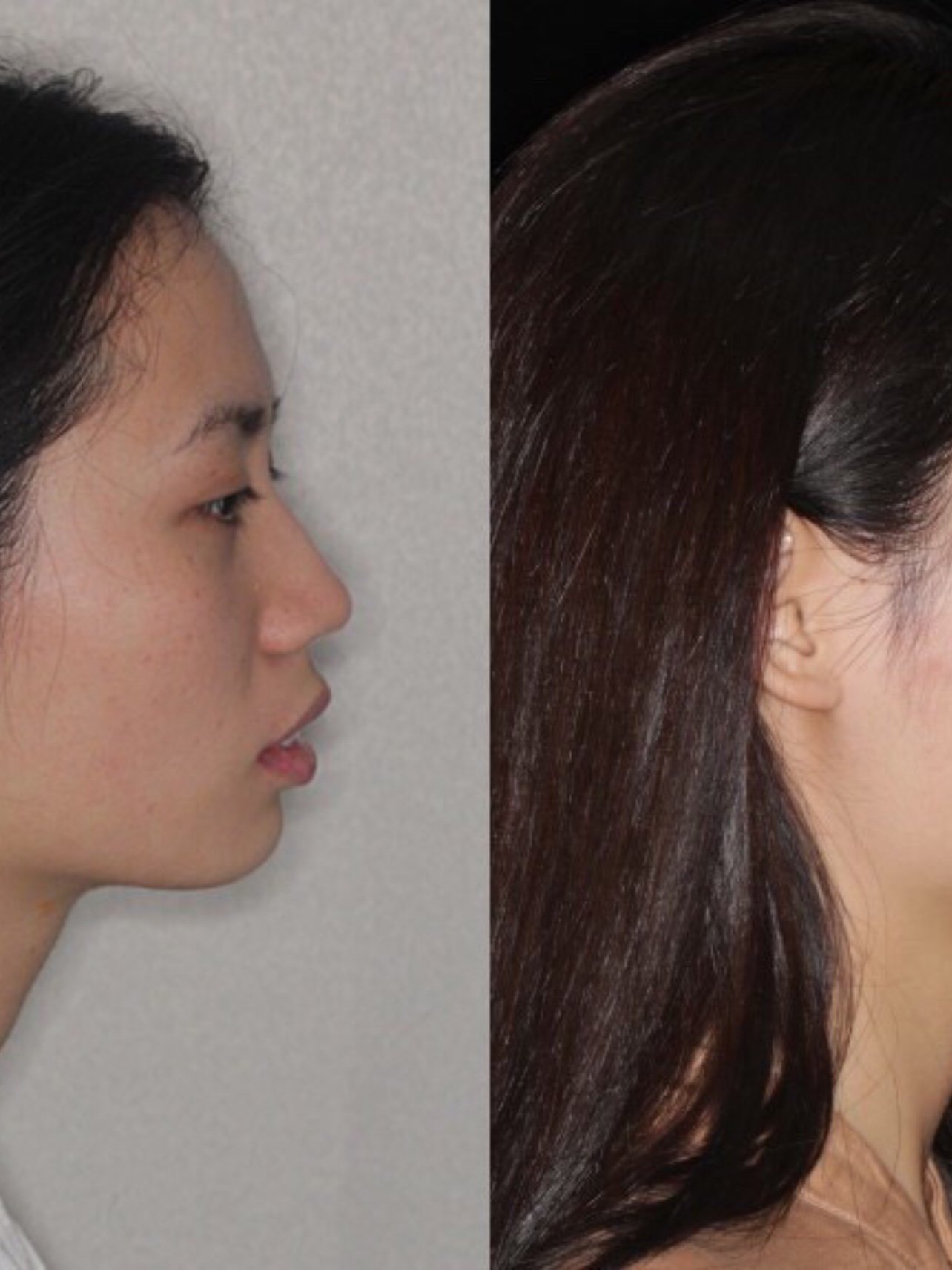 原相机拍摄的前后对比图,看的更真实一点!