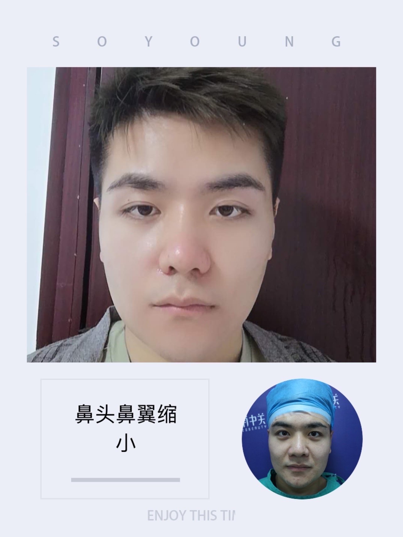 【鼻头鼻翼肥大】大鼻子男生的悄悄改变