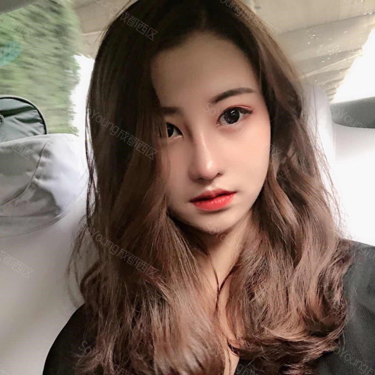 肋软骨隆鼻第三十天0269♀15成功渡过隆鼻的第一个月,_圈子