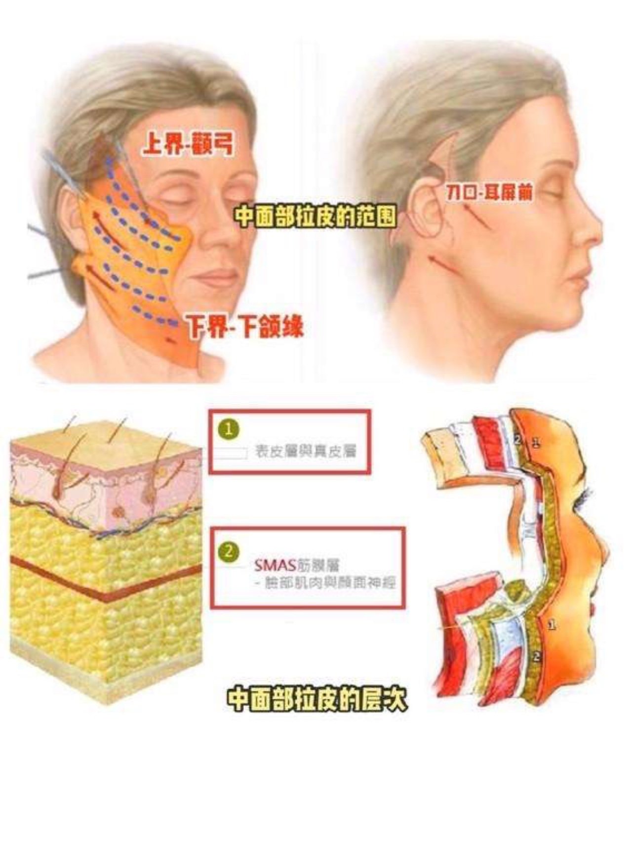 营销正旺的拉皮手术是否应该叫停?