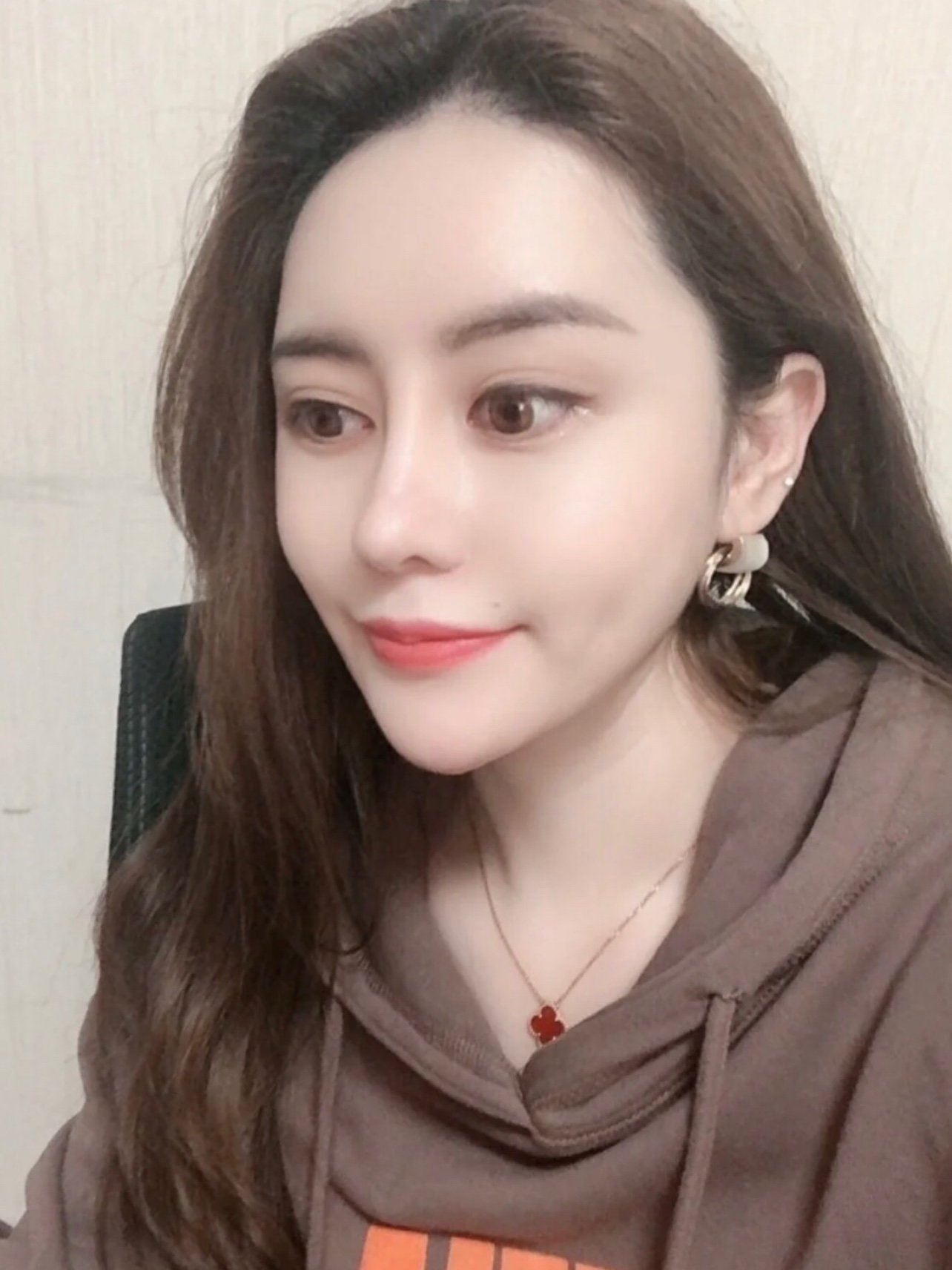 术后第15天鼻头很漂亮,鼻梁挺拔,鼻翼小巧,总体来_圈子-新氧美容整形