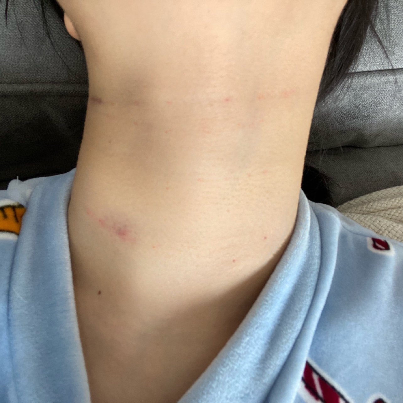 我从小到大都被颈纹的问题困扰,穿所有露脖子的衣服我都不敢带好看的