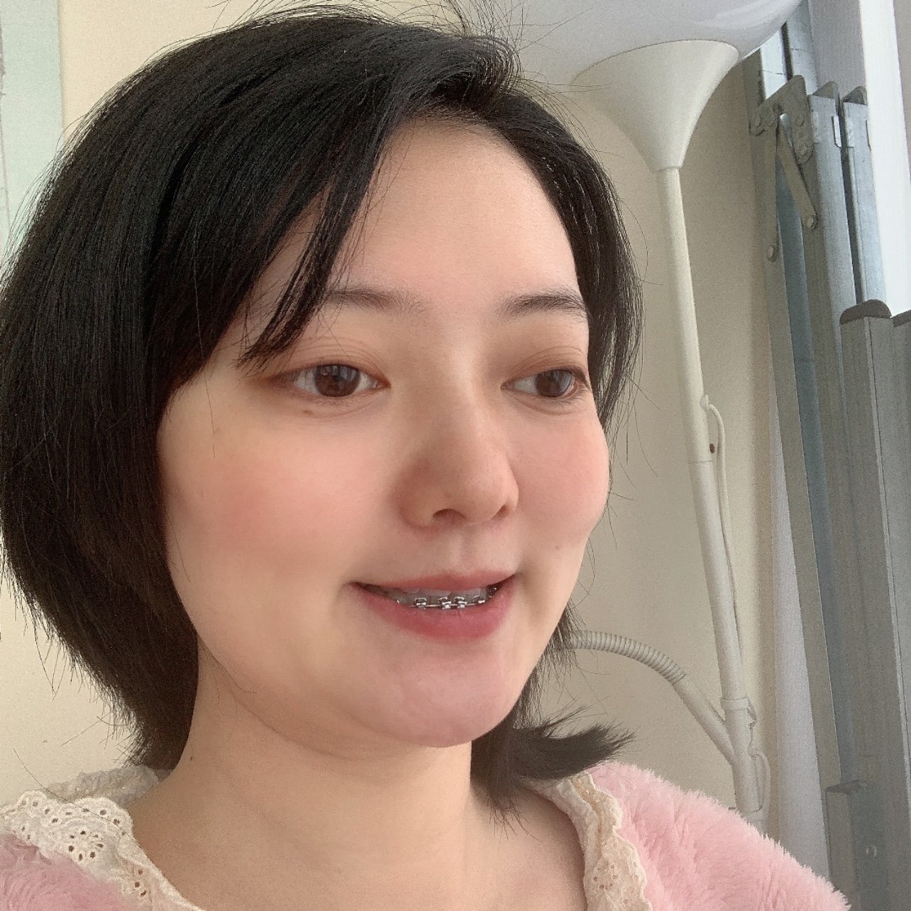 扇形下次下牙黑三角特别明显 三餐都有刷牙 估计上牙_圈子-新氧美容
