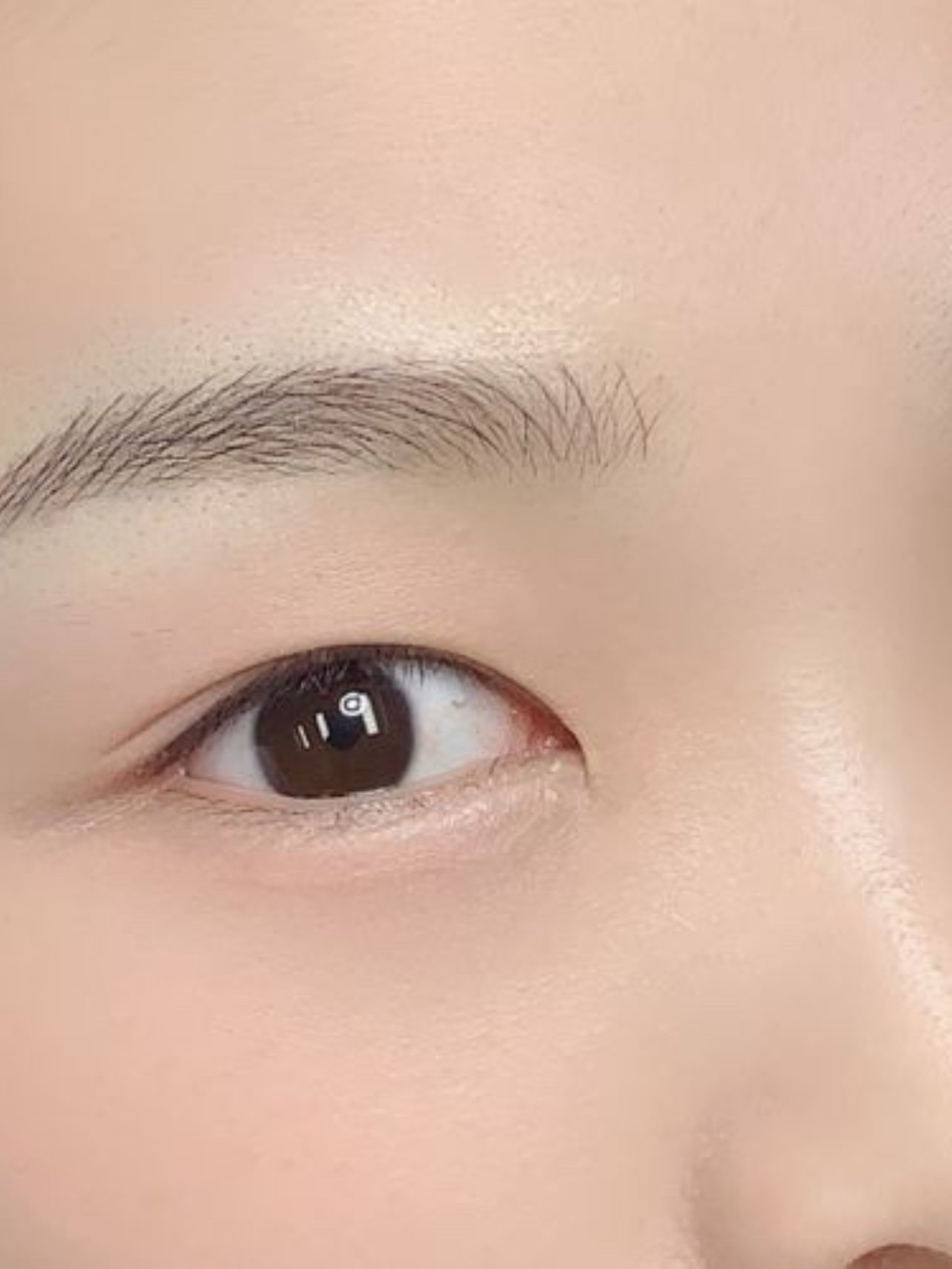 对于我这个半截眉毛的人来说,卸了妆没有眉毛真的很是_圈子-新氧美容