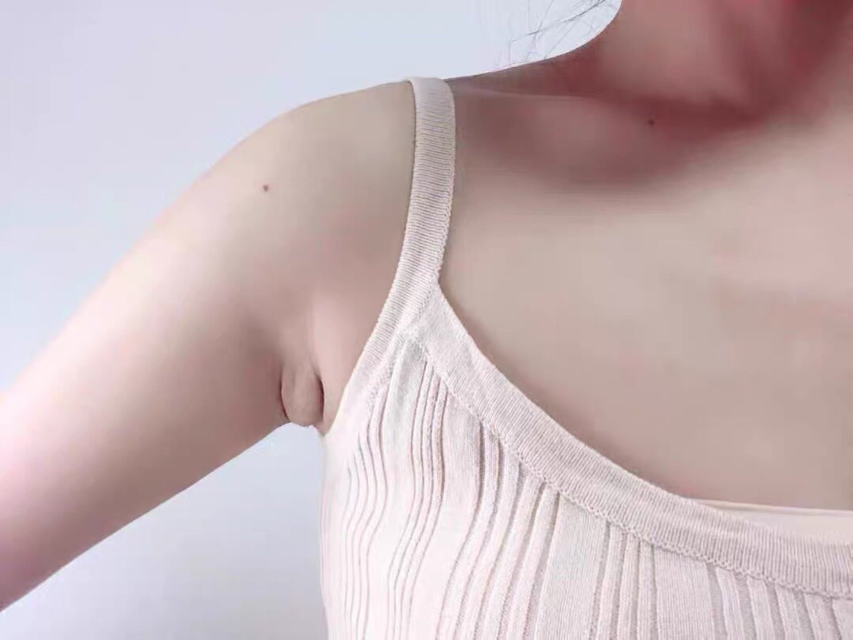 副乳一定要尽早去掉,越到后面会越大的,我是产后出现_圈子-新氧美容