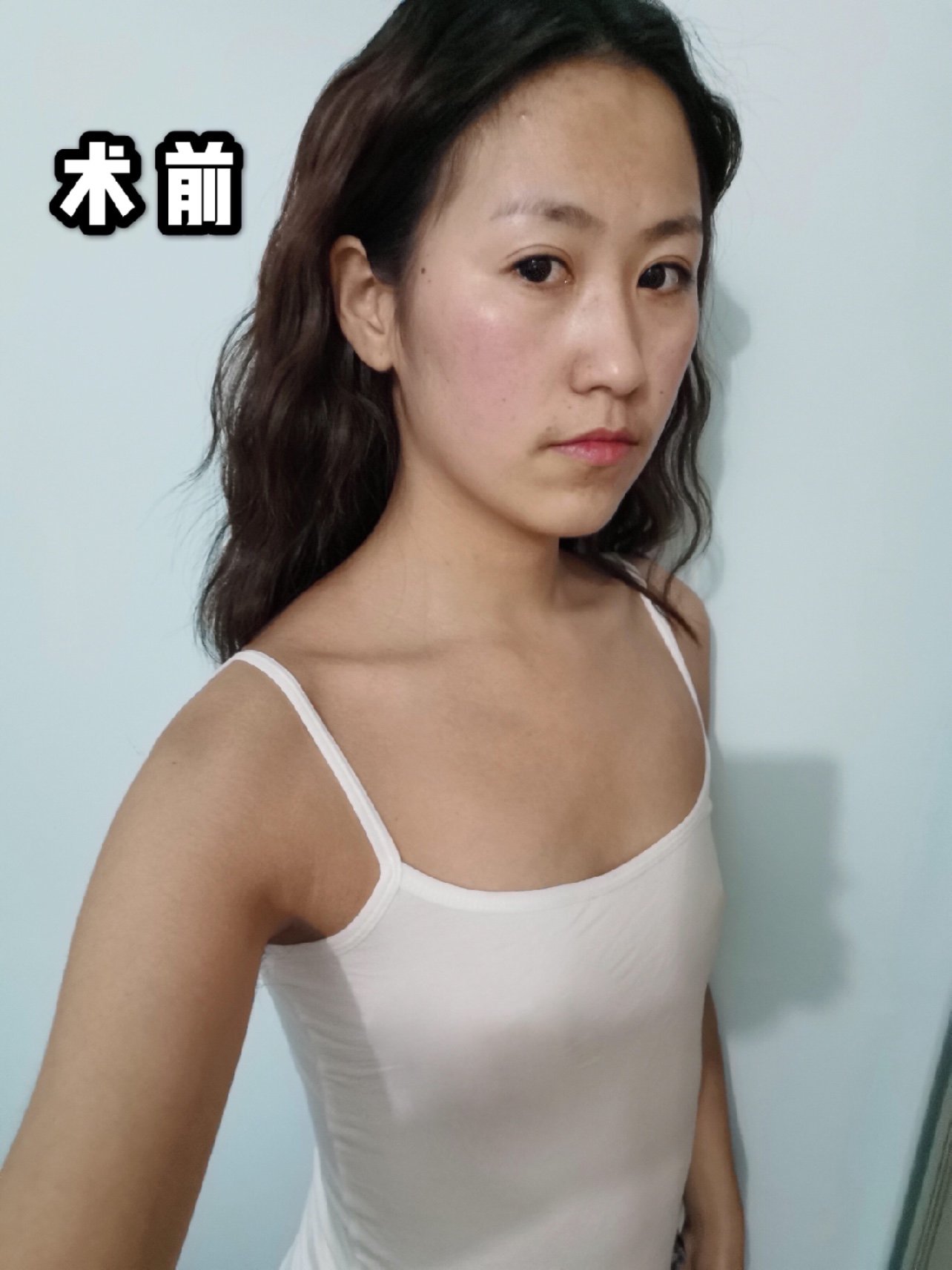 胸大了,以前的内衣都不适合,不能穿了,所以要全部换_圈子-新氧美容