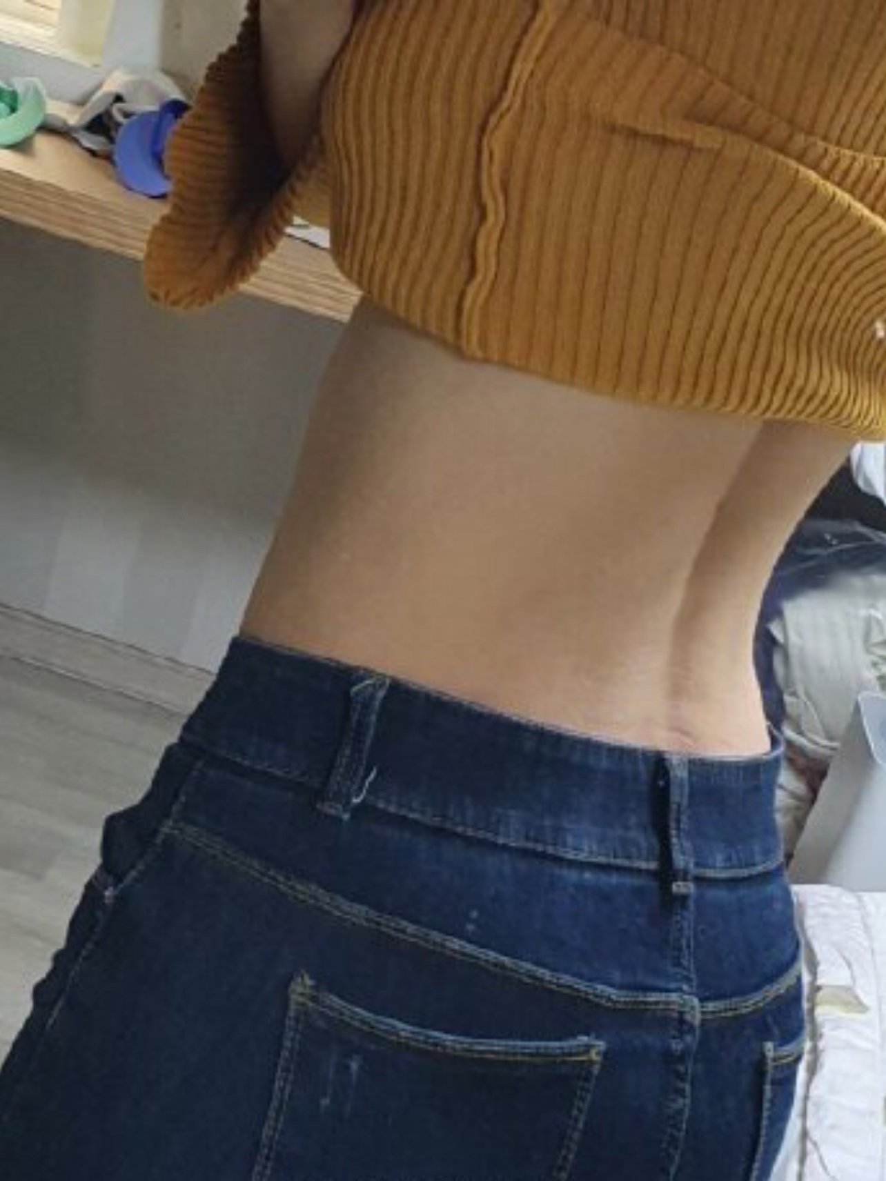 我做的是腰腹环吸,现在腰部两侧的脂肪赘肉已经没有了_圈子-新氧美容