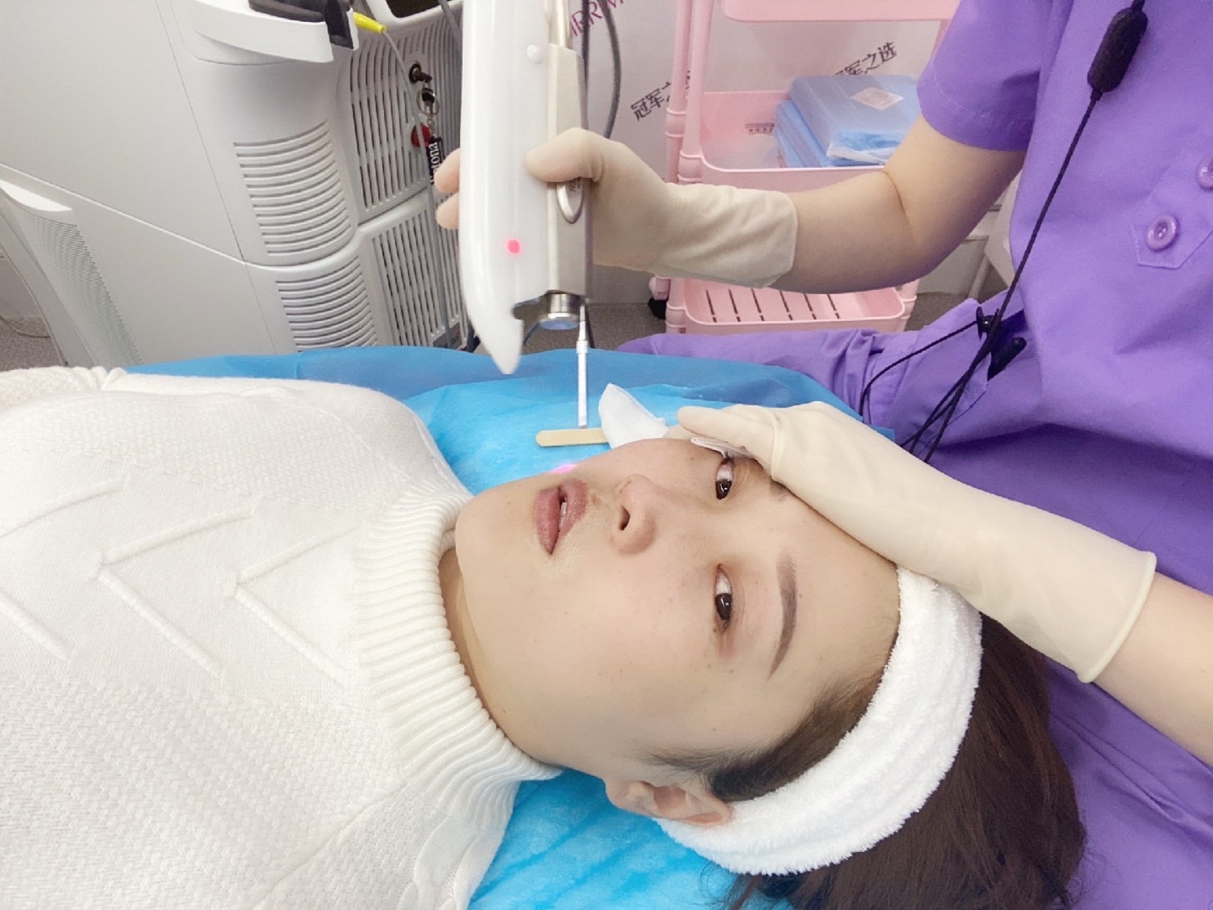 fotona 4d欧洲之星面雕半个月效果分享