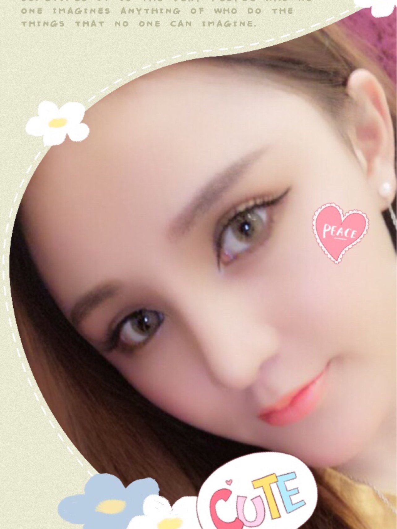 鼻部多项做完之后我也变成混血风了,真是一个鼻子拯救_圈子-新氧美容