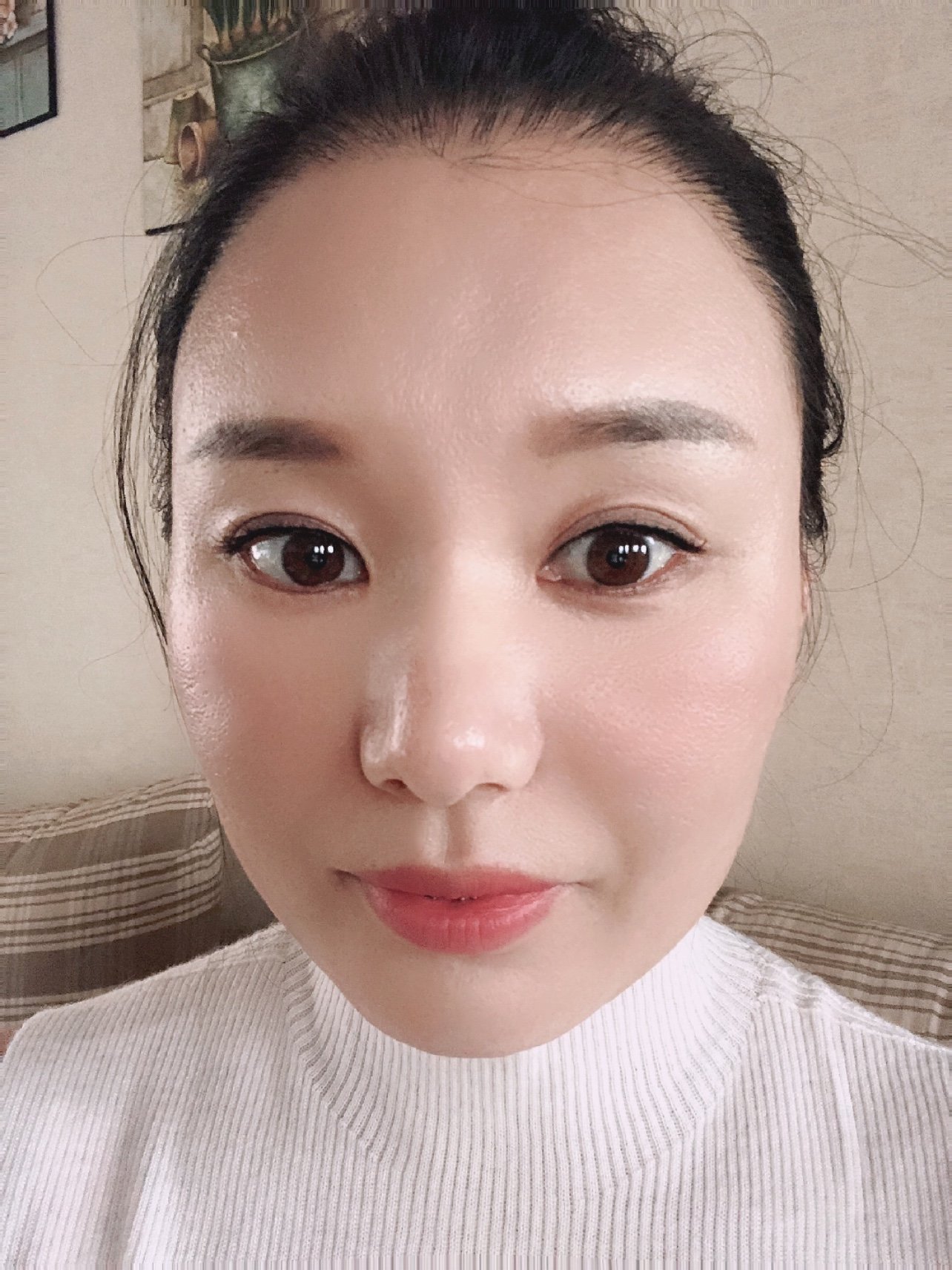 我也很想拥有一张漂亮的小脸蛋,饱满圆润,精致小巧,_圈子-新氧美容