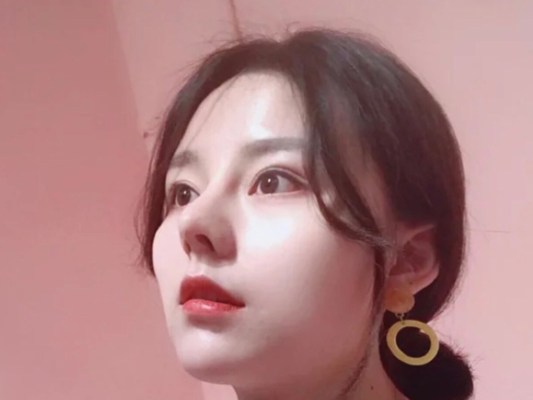 我随了我爸的大肉鼻子,鼻头很大,从小别人就觉得我憨_圈子-新氧美容