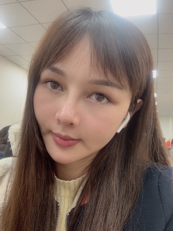 我以前鼻头有点肉,山根基本上没有,前两年刚打了玻尿酸的时候看着挺好