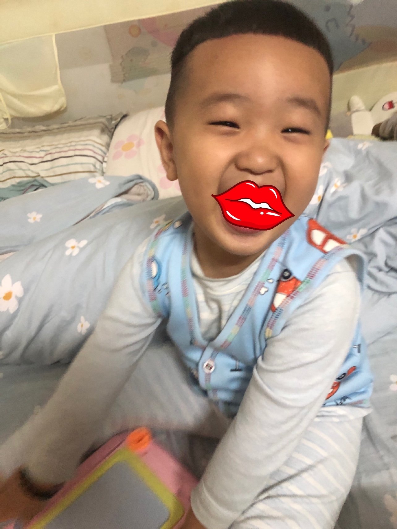 新氧体验官被两岁的孩子打成胸膜炎