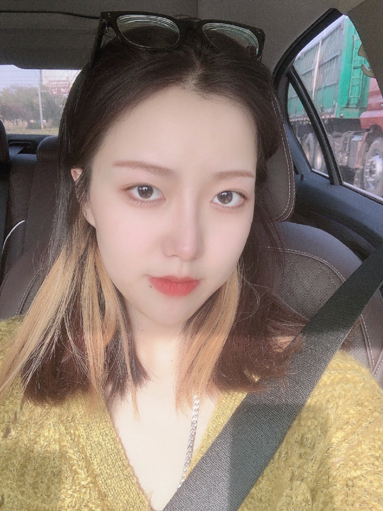 现在术后已经五个月了,鼻子恢复的特别好,随便拍照发朋友圈都能引来