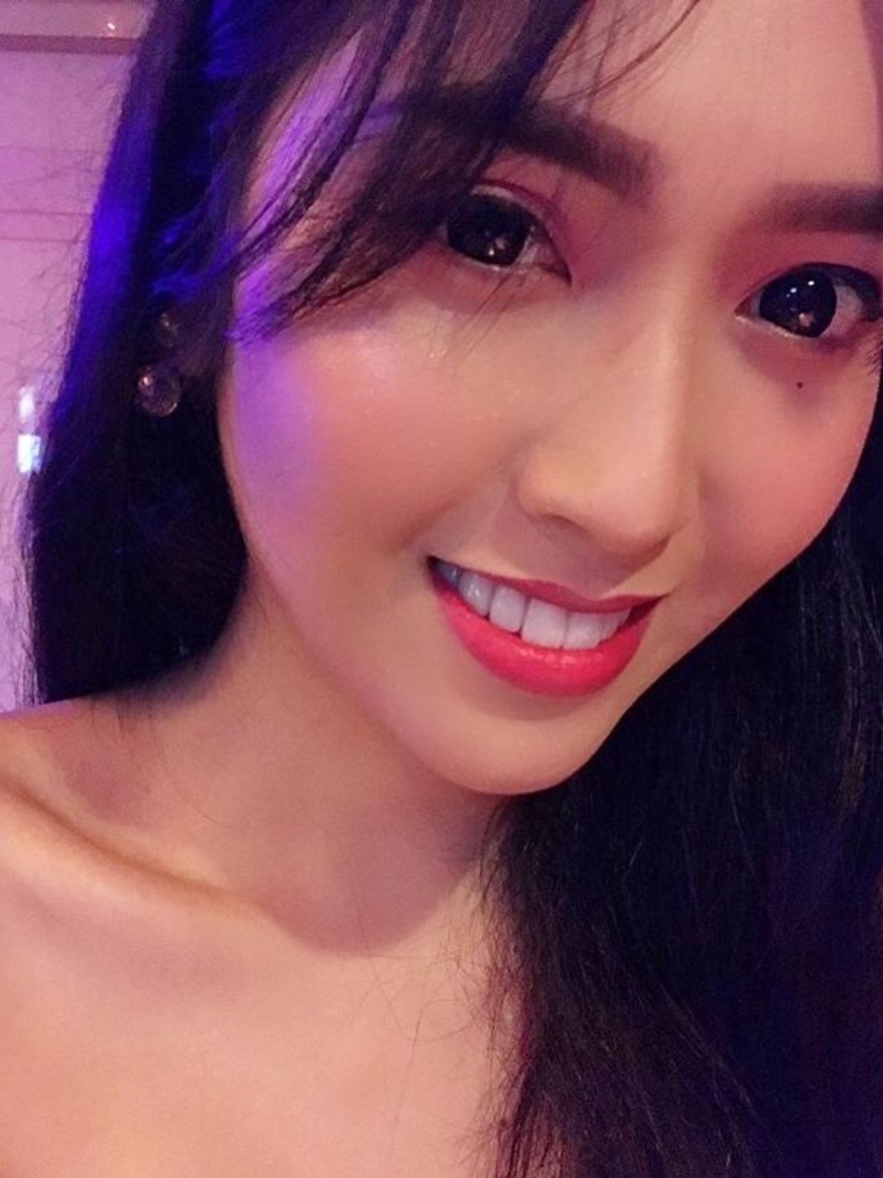 医生建议我用的是超薄3d牙贴面,磨牙没有很多,只磨_圈子-新氧美容整形