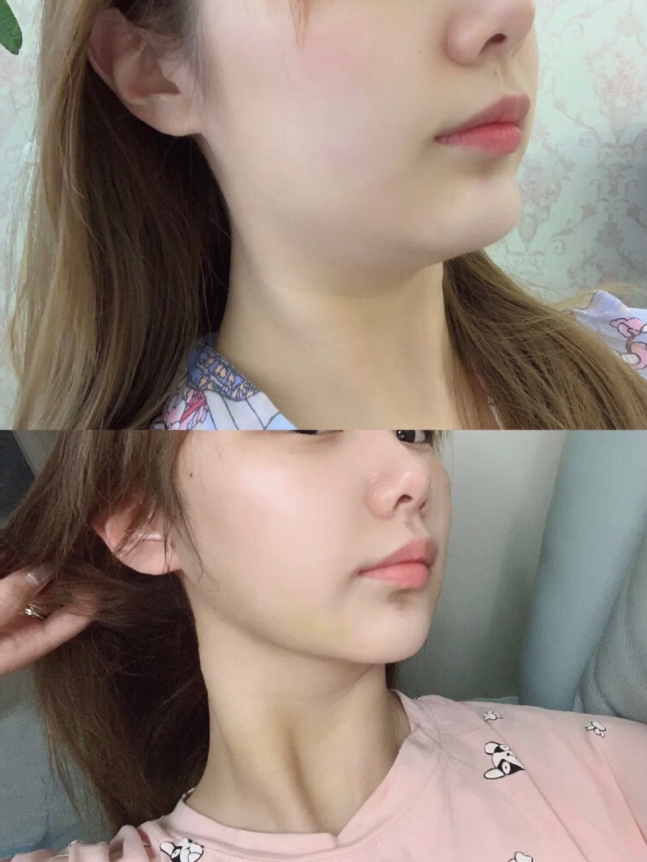 96我们面部的肌肉多为条状肌肉,每条肌肉就像一条可