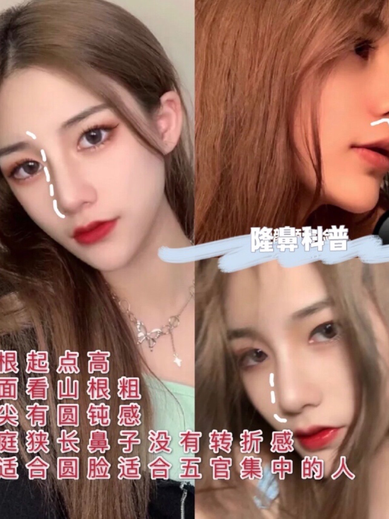 隆鼻功课|英气高挺直鼻整容模板!必看!