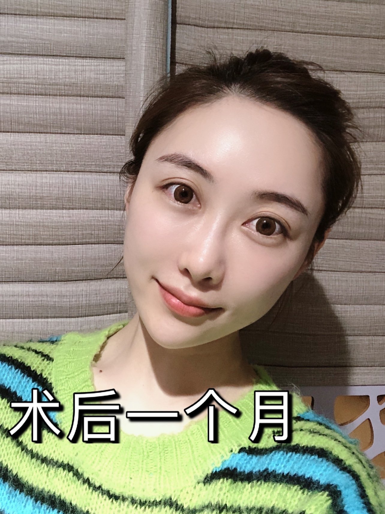 进行脸部微调96159615有"微调"_圈子-新氧美容整形