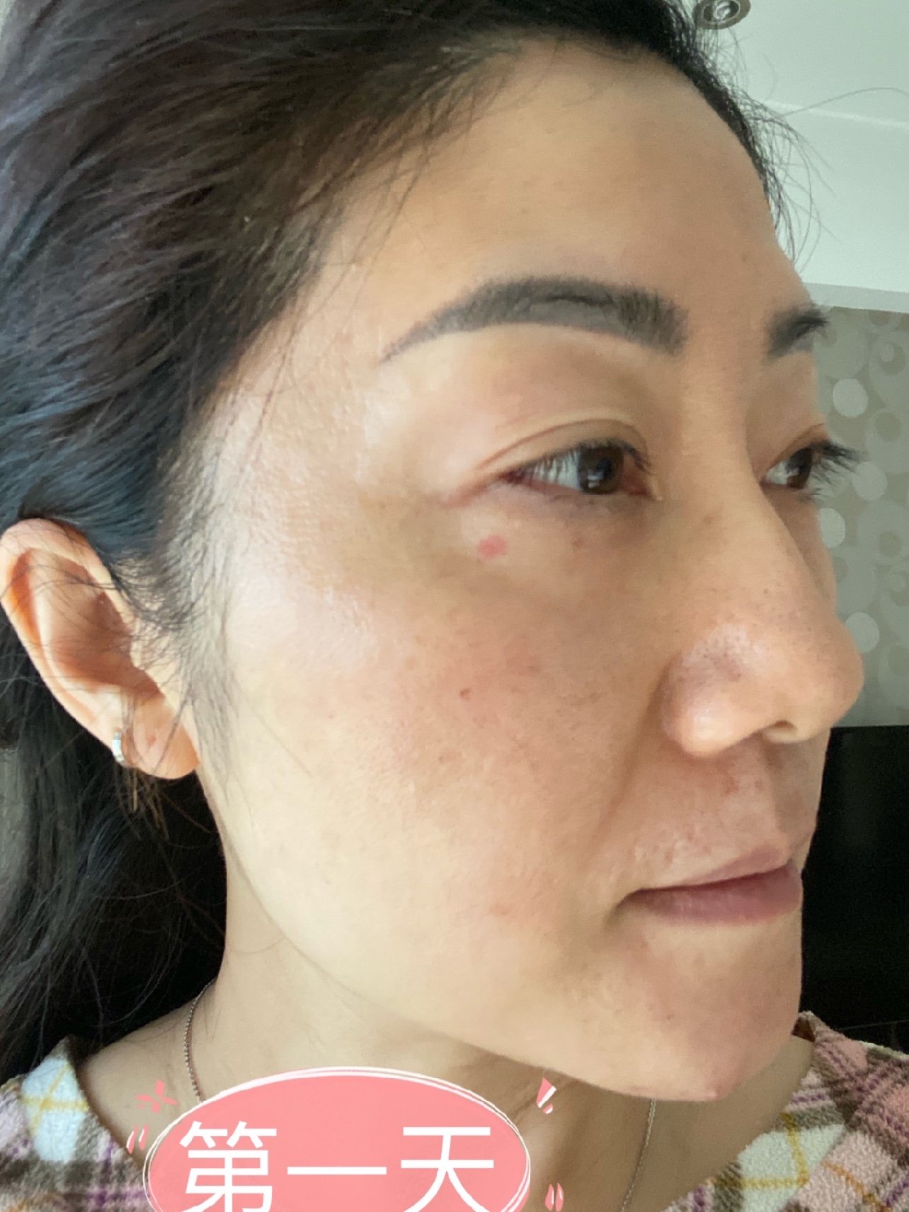 脸上的斑斑点点皮肤暗沉发黄真的看不下去了咨询了几家美容机构最后