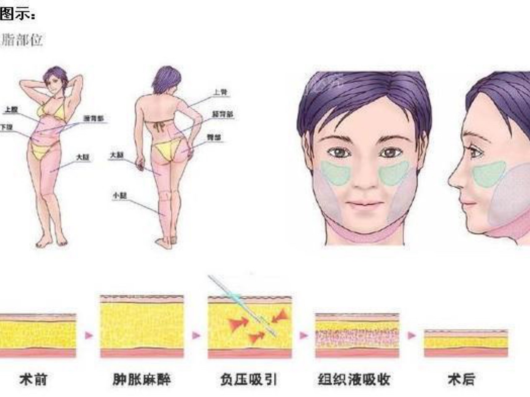 面部脂肪的分布面部皮下脂肪不是整体,是一小块一小块_圈子-新氧美容