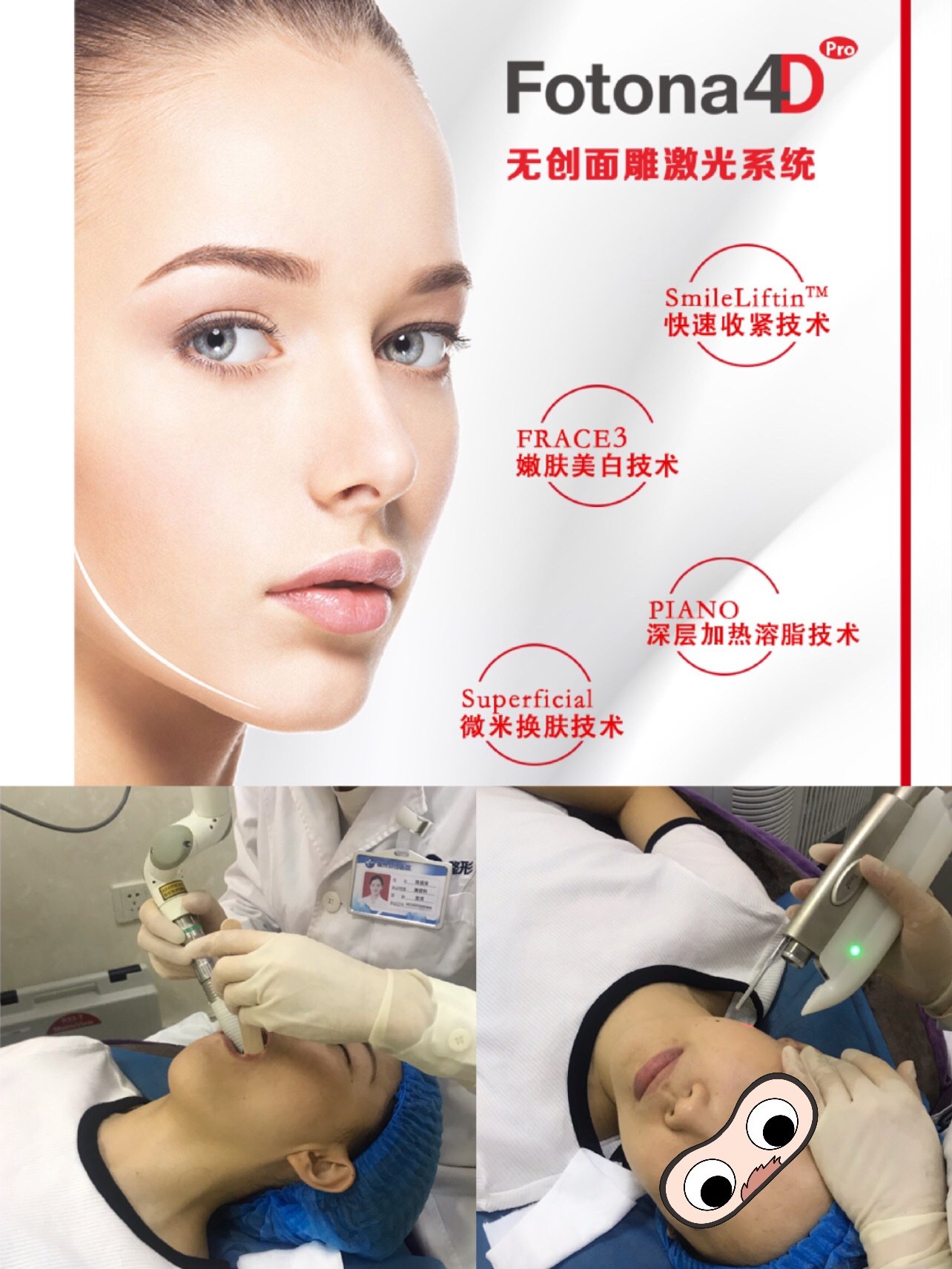 新氧体验官fotona欧洲之星994d面雕foto_圈子-新氧美容整形