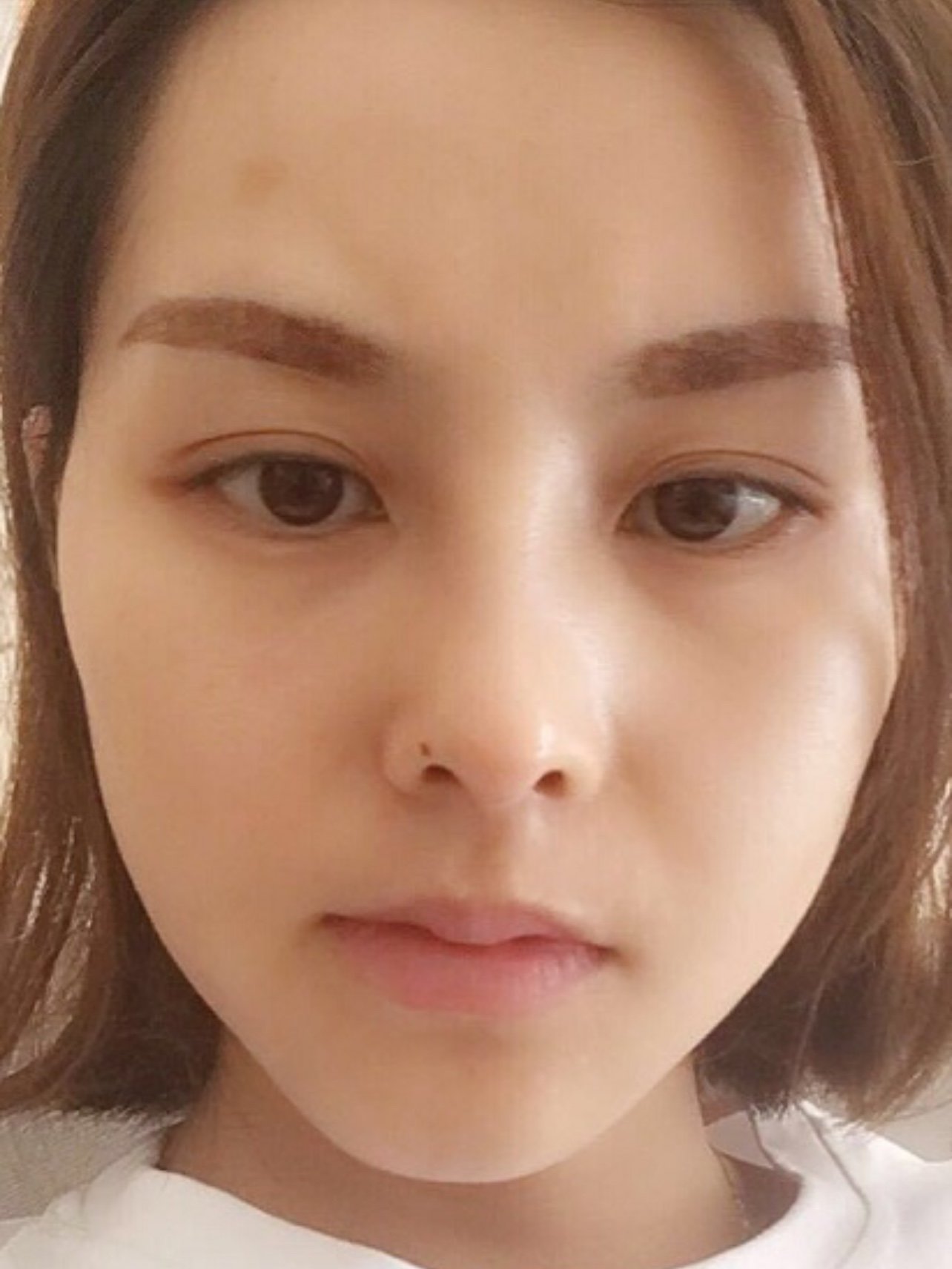 【玻尿酸】润百颜 润百颜白紫 1ml ,[大家都在买] 人气款润百颜白紫1