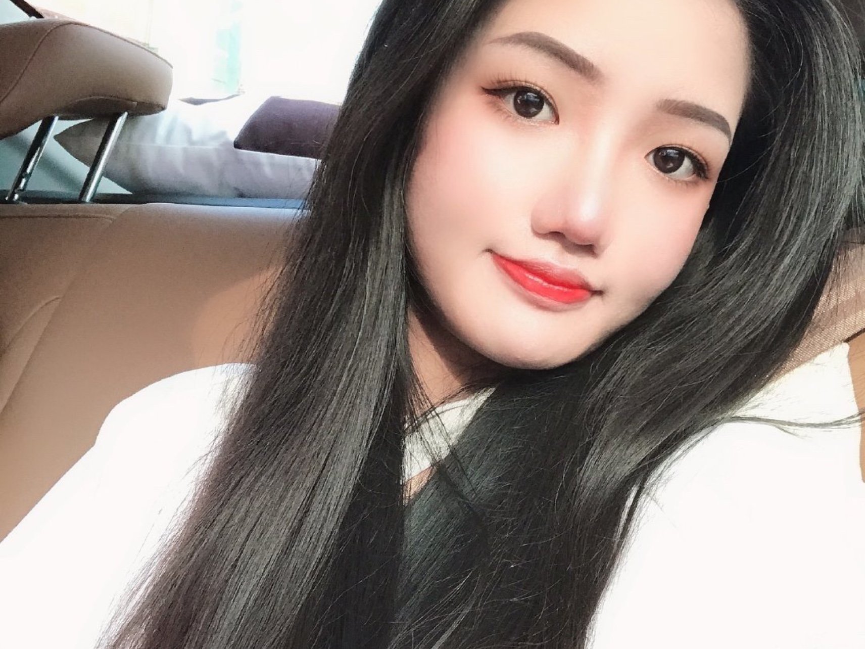 凹进去的额头终于凸出来啦,哈哈哈哈,好事多磨,考虑_圈子-新氧美容