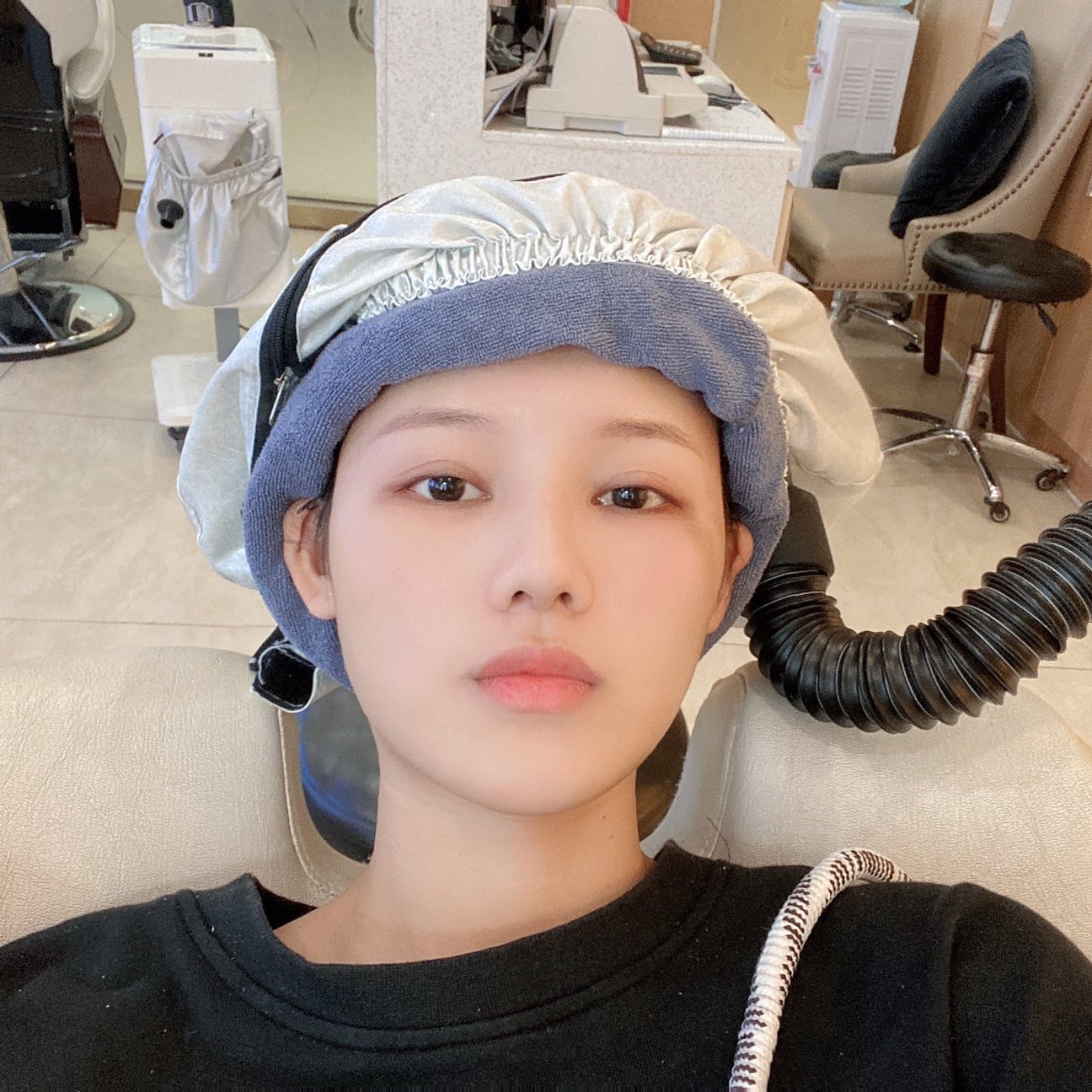 大麦微针植发·术后1个月7373真的是换头计划了,小发_圈子-新氧