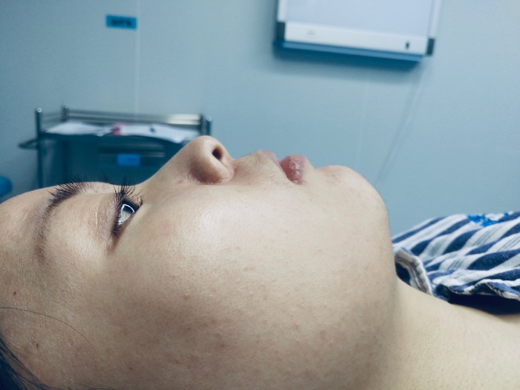 一直就觉得下巴很平,拍照不好看,而且大家都说是下巴_圈子-新氧美容