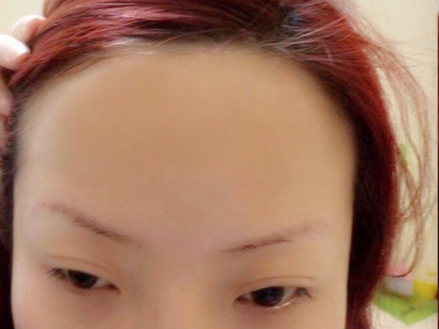 没做前,眉毛比较稀疏,形态不好看,也考虑过纹眉,但_圈子-新氧美容整形