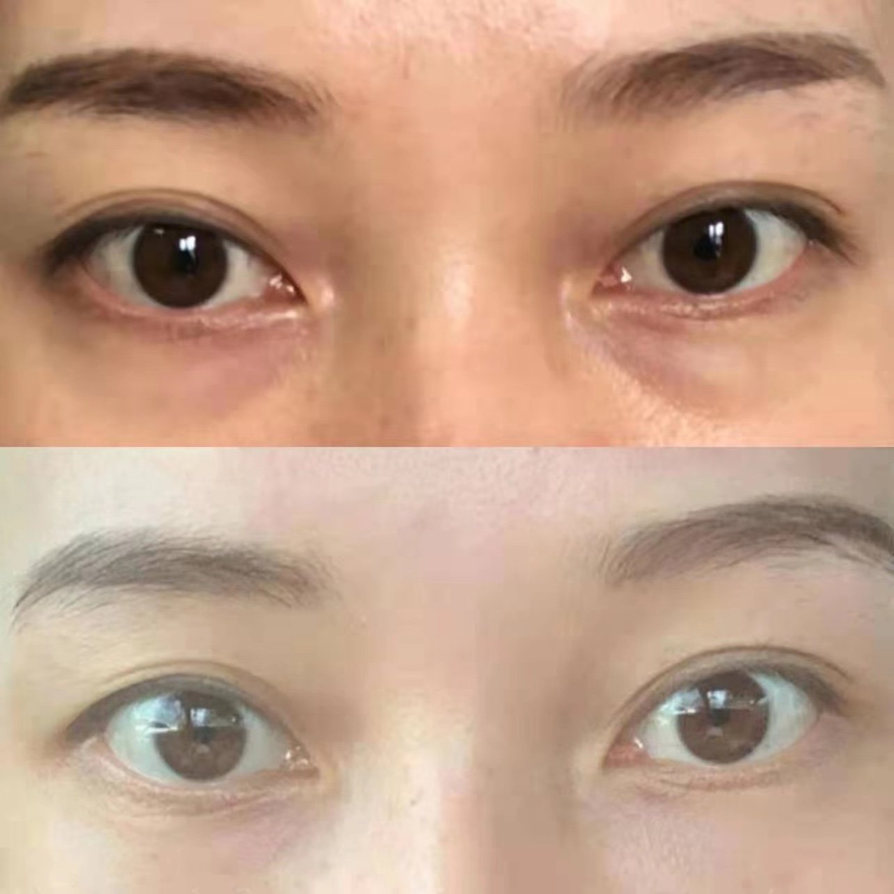 嗨体熊猫针真的绝了!