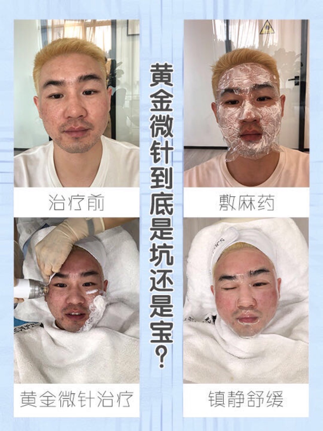 熟悉我的宝宝应该知道我的毛孔是挺大的,之前也一直