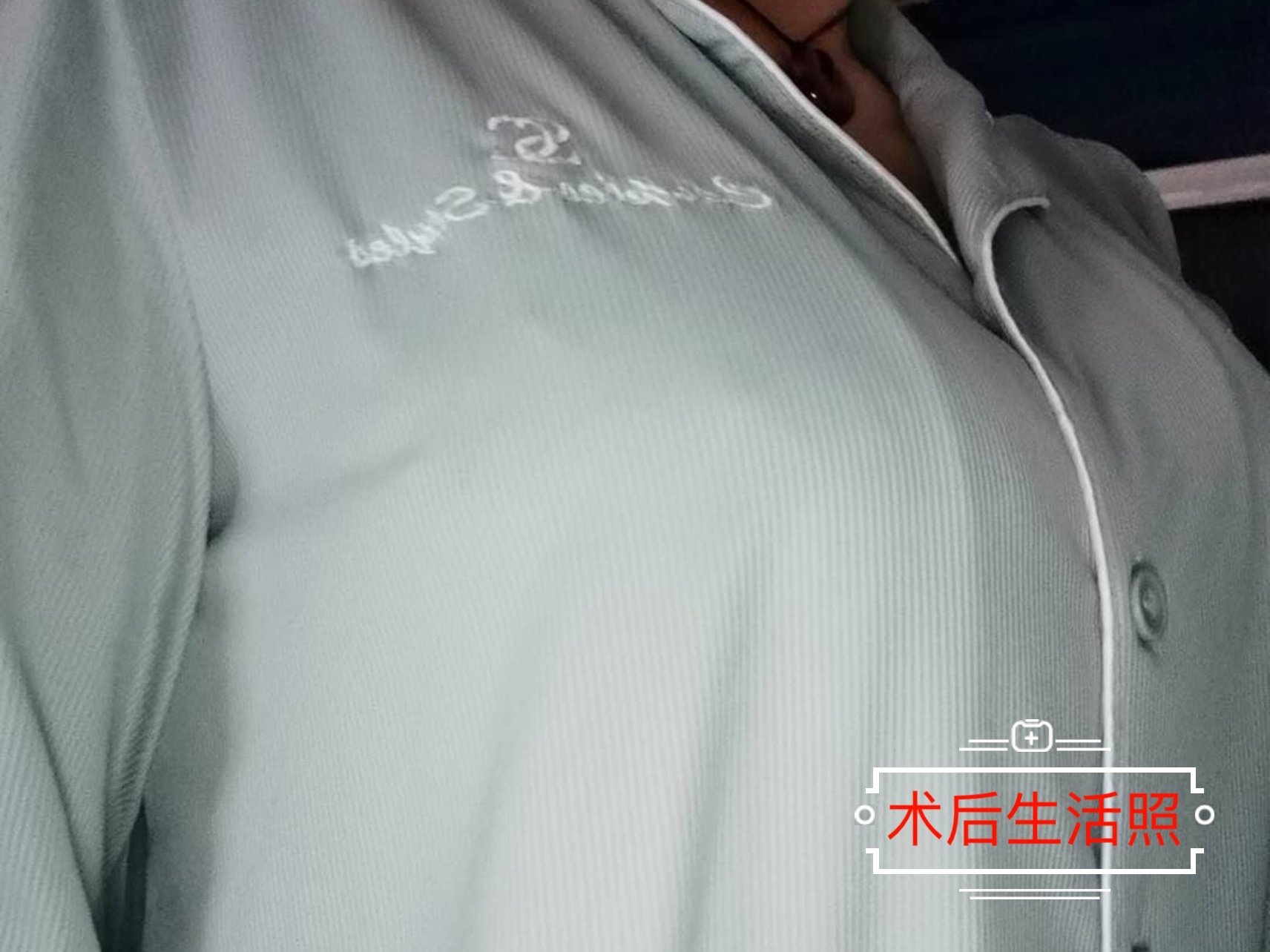 959595【术前诊断】:患者术前为双侧乳房不对称,推测_圈子-新氧