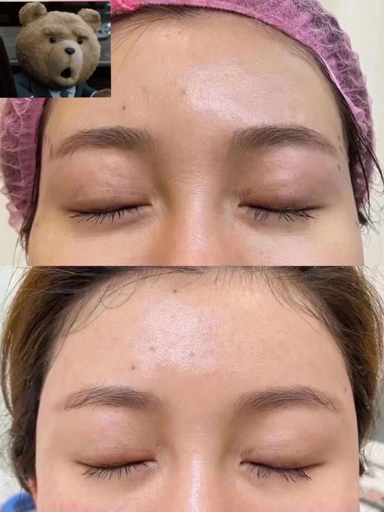 夫妻宫一定要填充起来