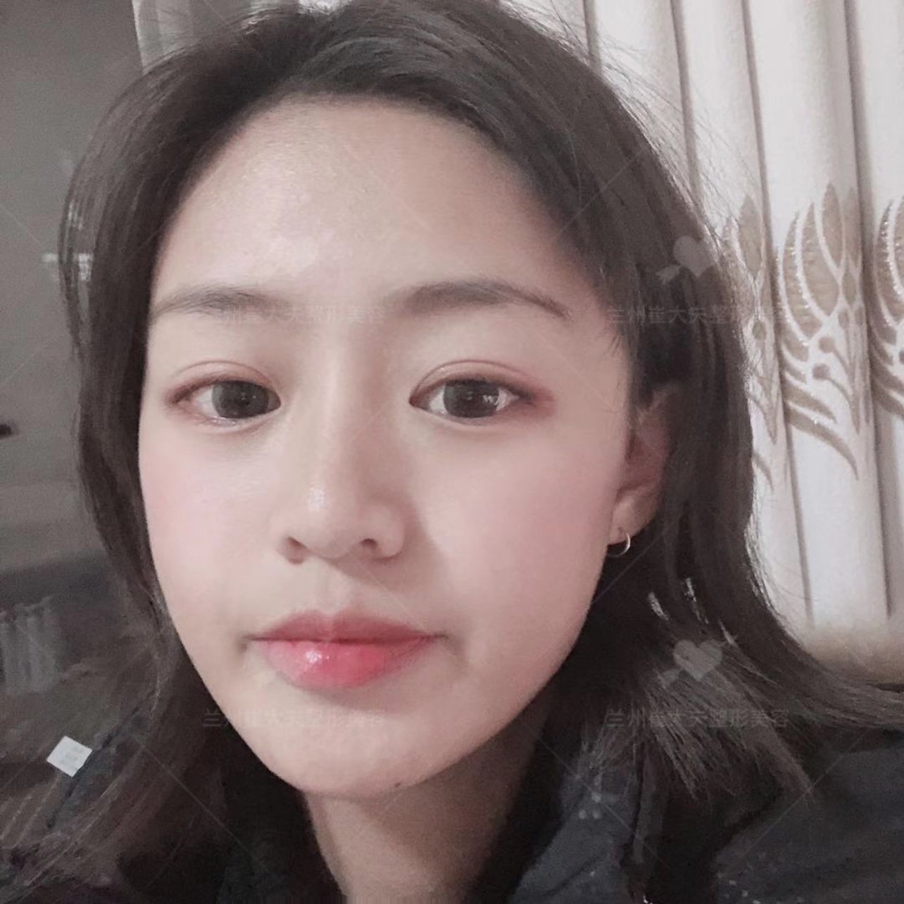 【术前诊断】:求美者整体面部轮廓凹凸不平,缺乏元气_圈子-新氧美容