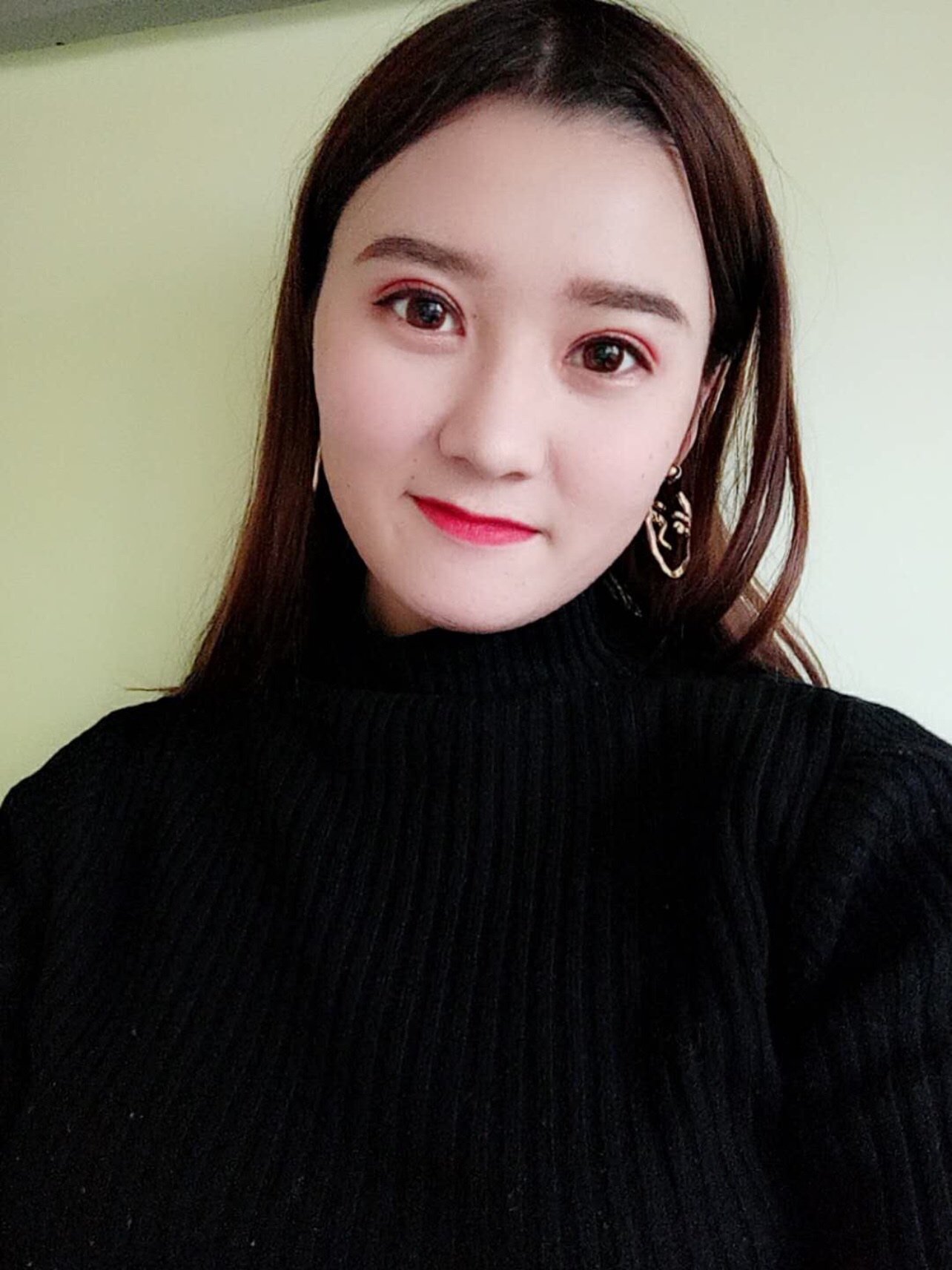 第一张是我单眼皮的自拍,第二张大概是做完15天左右_圈子-新氧美容