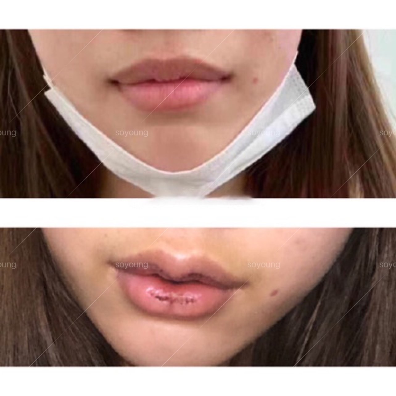 超级喜欢网红的那种嘴唇,感觉特别性感,但是我自己嘴