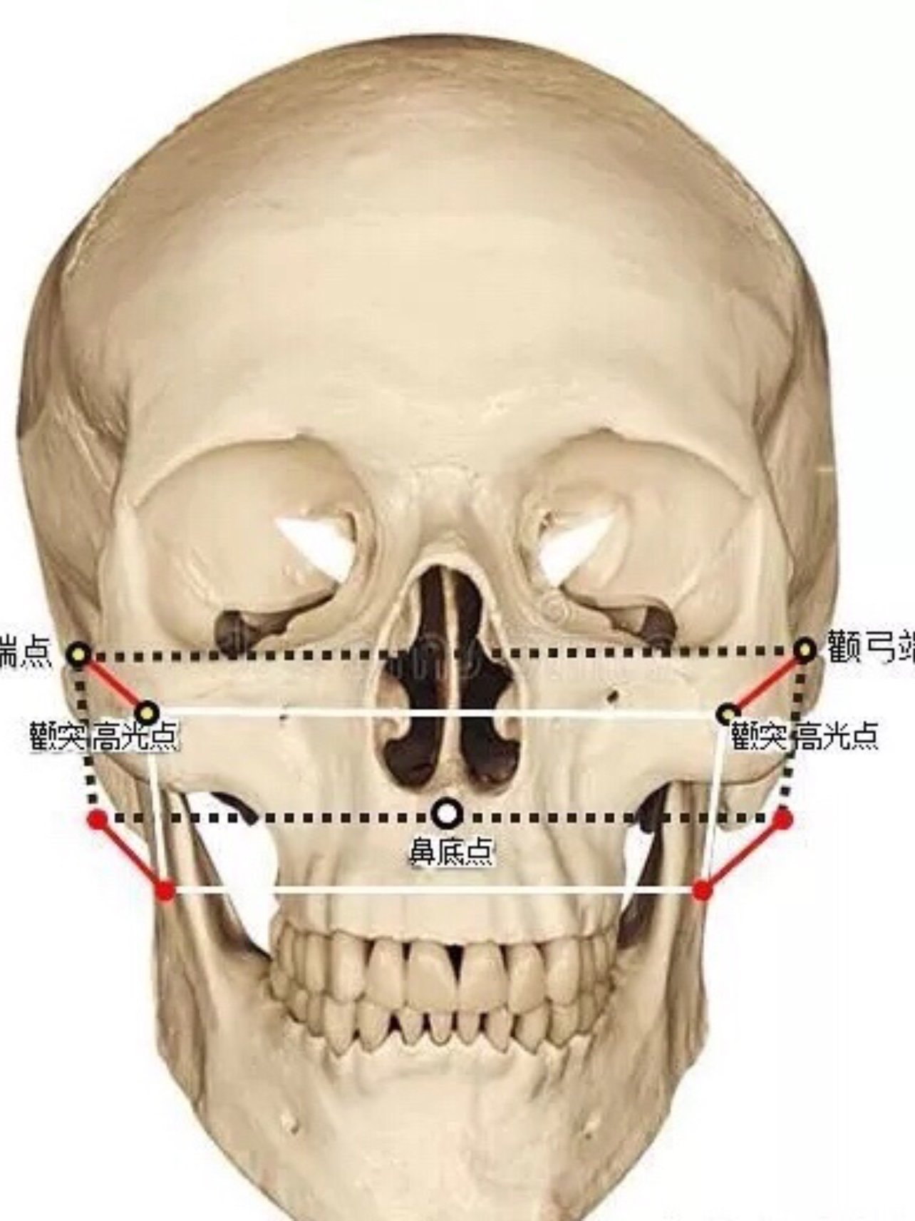 做磨颧骨有哪些注意事项