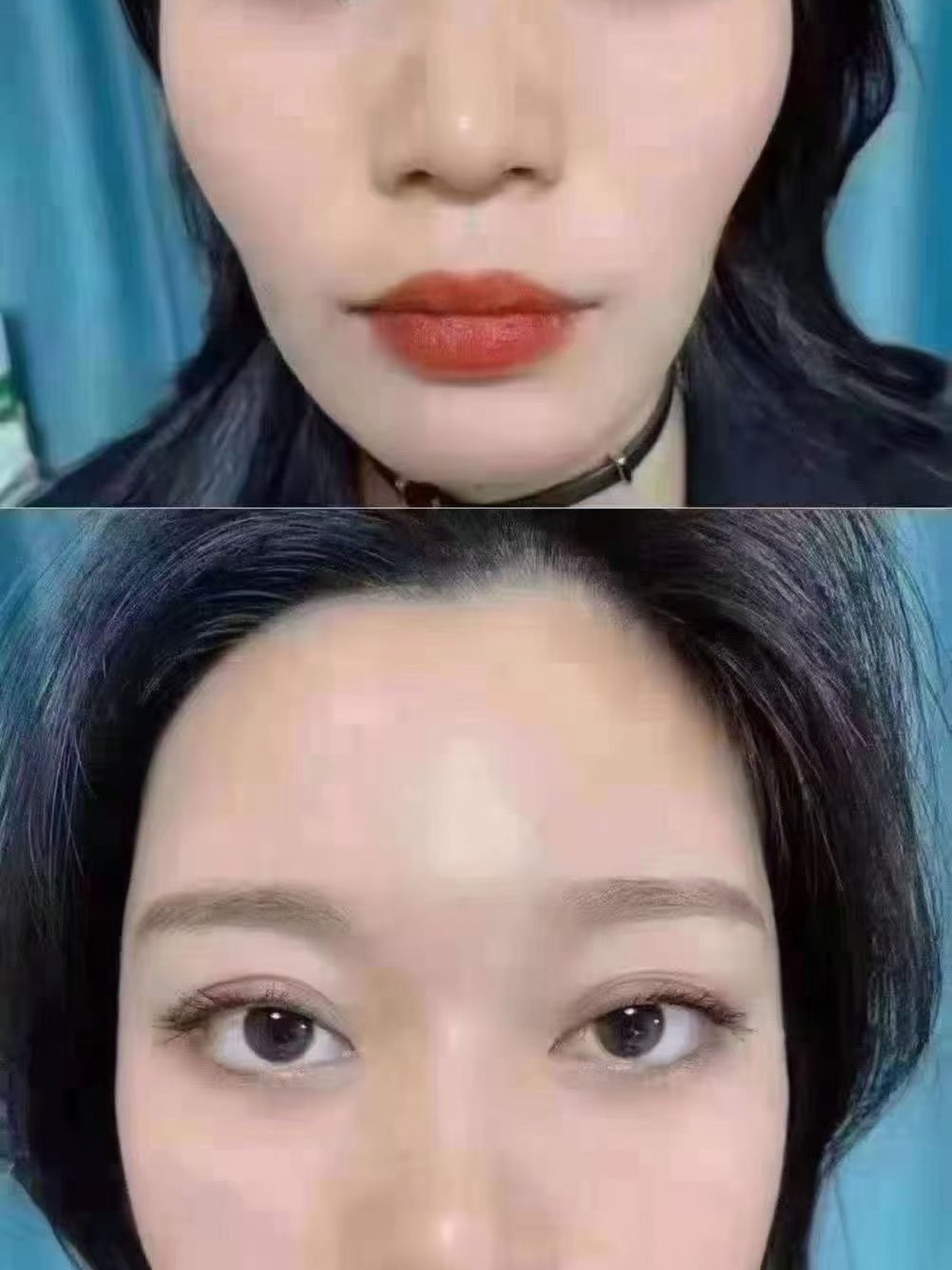 其实微调,整形,抗衰的效果就是多年以后