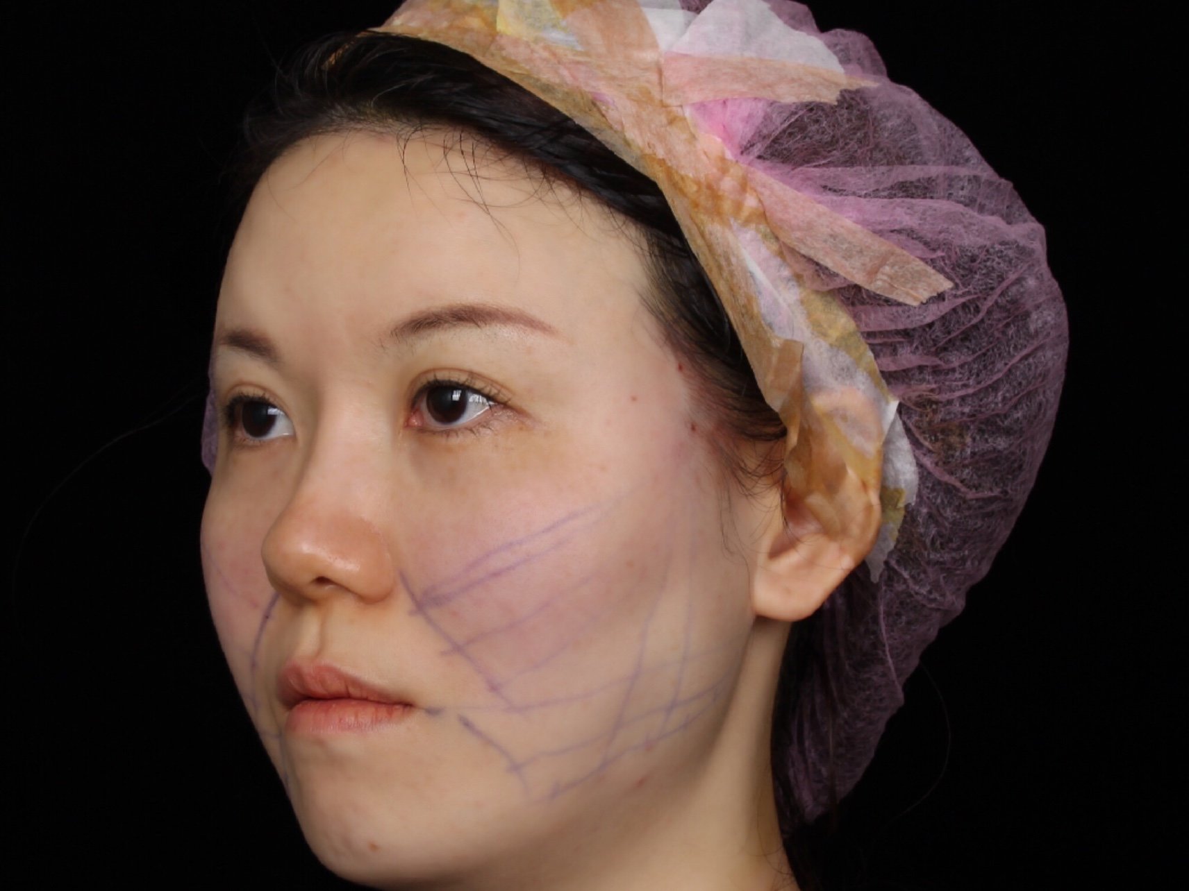 纯干货 | 线雕大v线100%真实分享