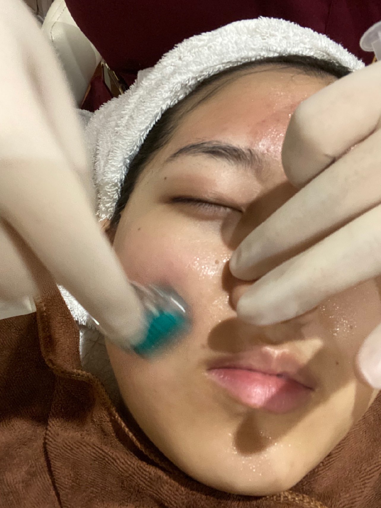 3图 50字优质评分日记挑战 伊肤泉小黄瓶微针体验分享