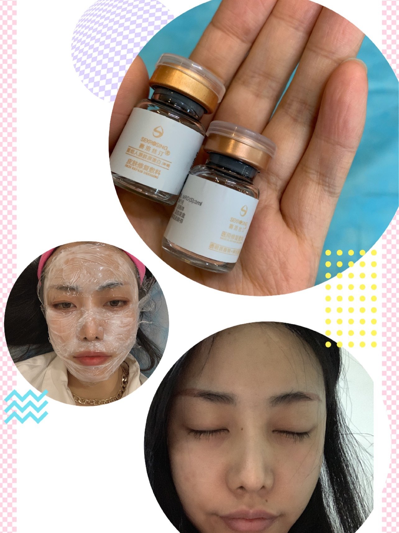 赛洛斯汀逆龄胶原微针试用官