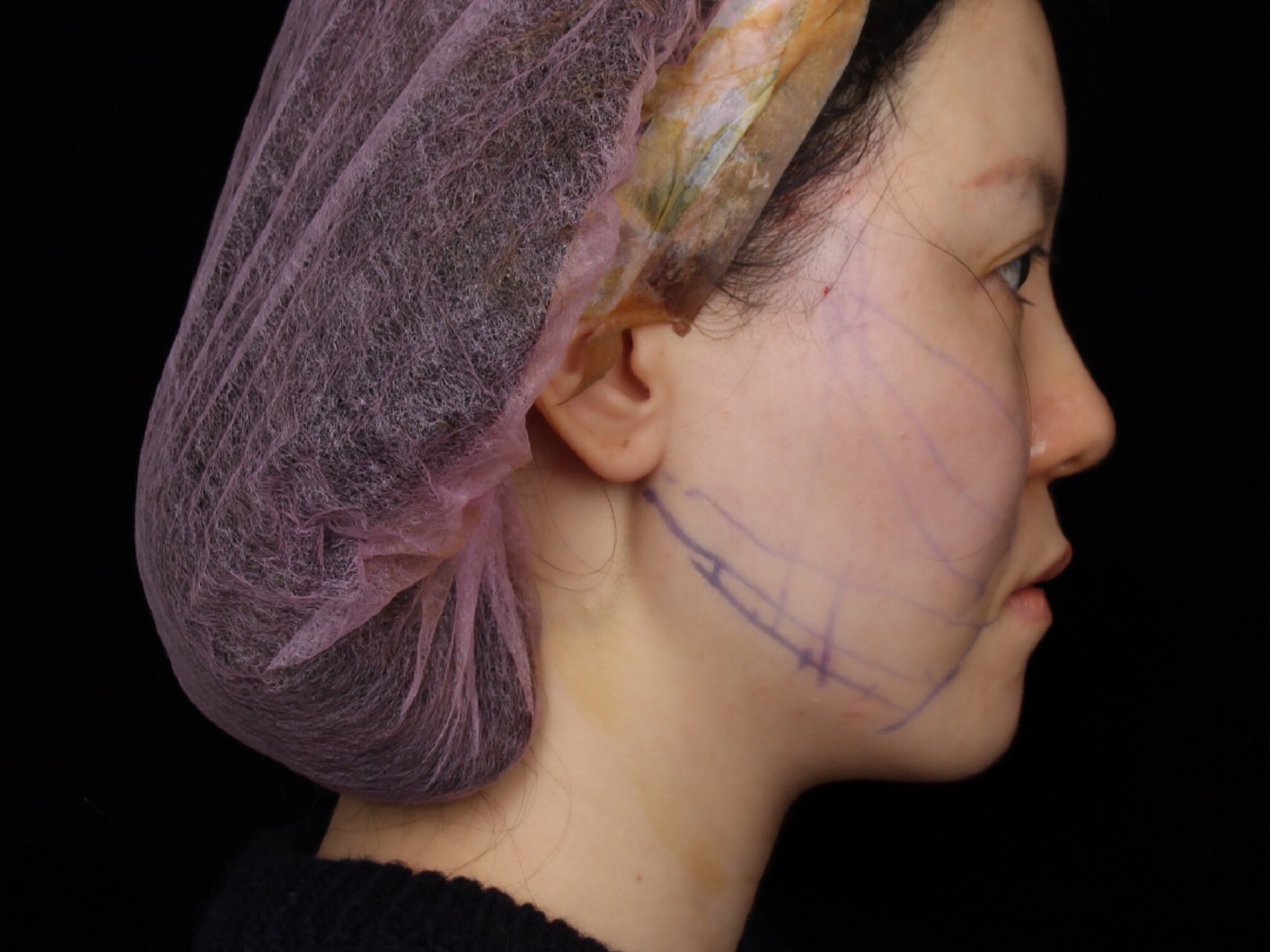 纯干货 | 线雕大v线100%真实分享