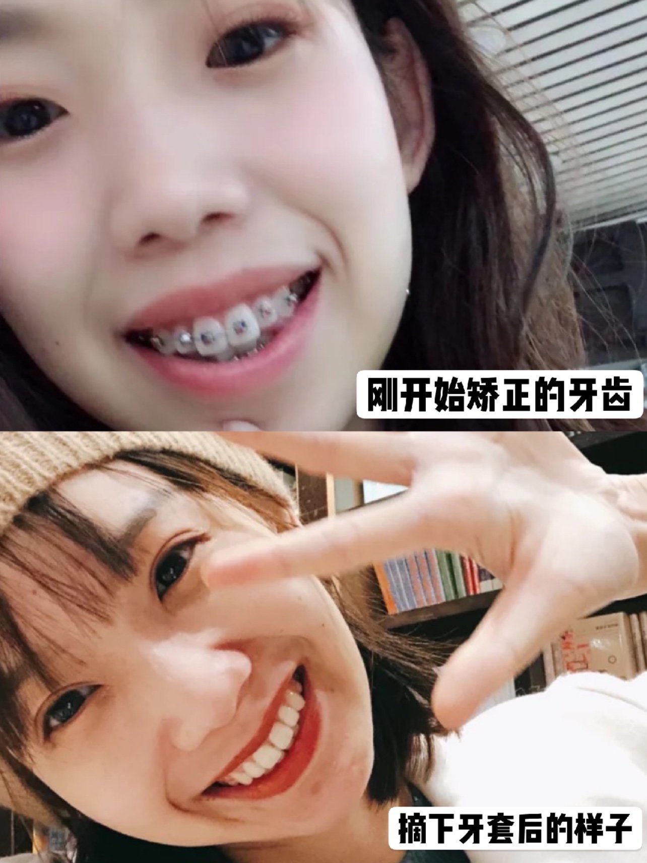 从齿开始过新年