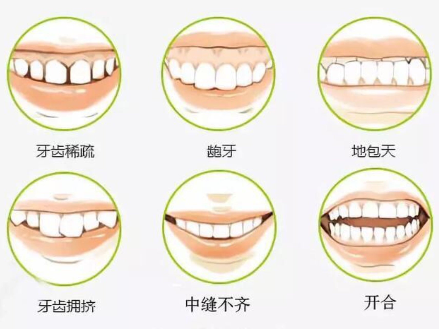 牙齿面相学图解图片