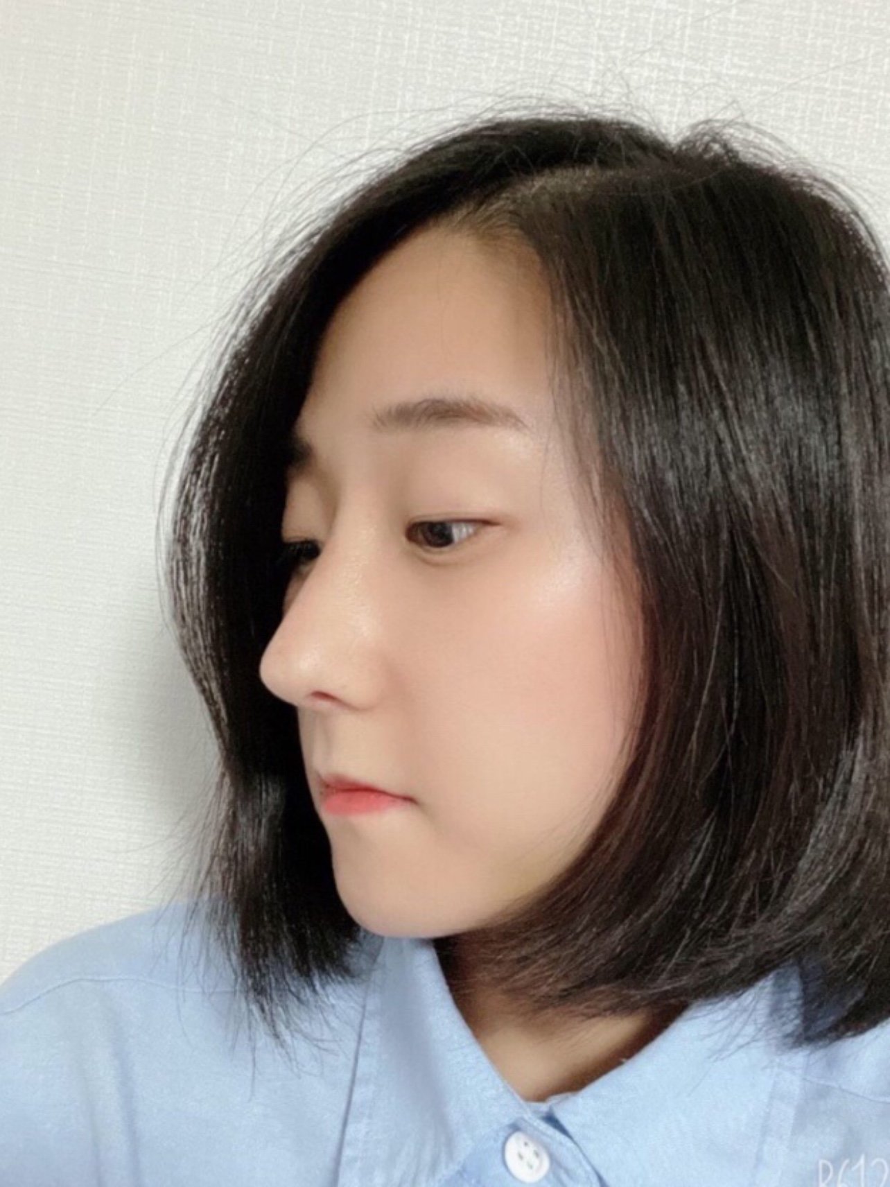 鹰钩鼻矫正|不知道有没有姐妹和我是同款鼻子?