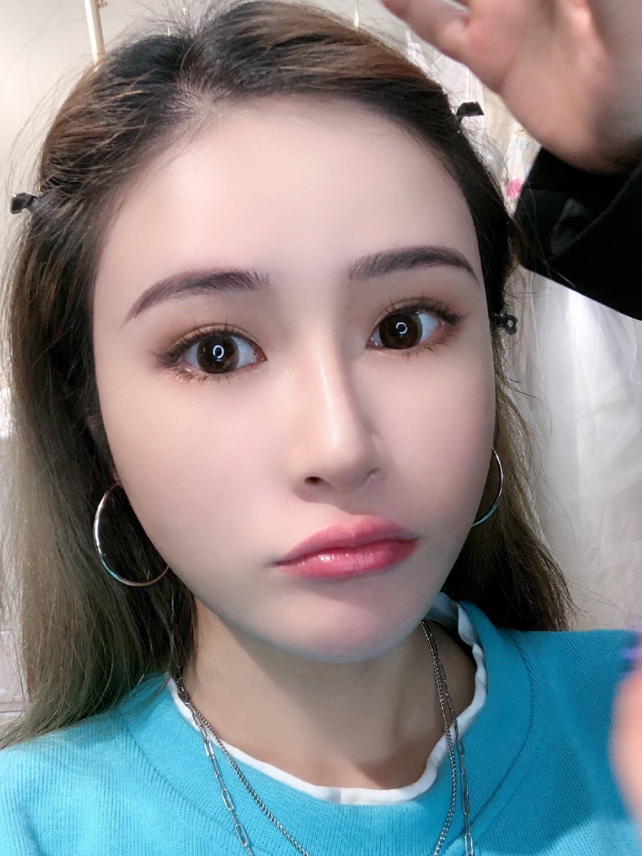 姐妹们看我现在的皮肤是不是特别的嫩啊,而且白里透红_圈子-新氧美容