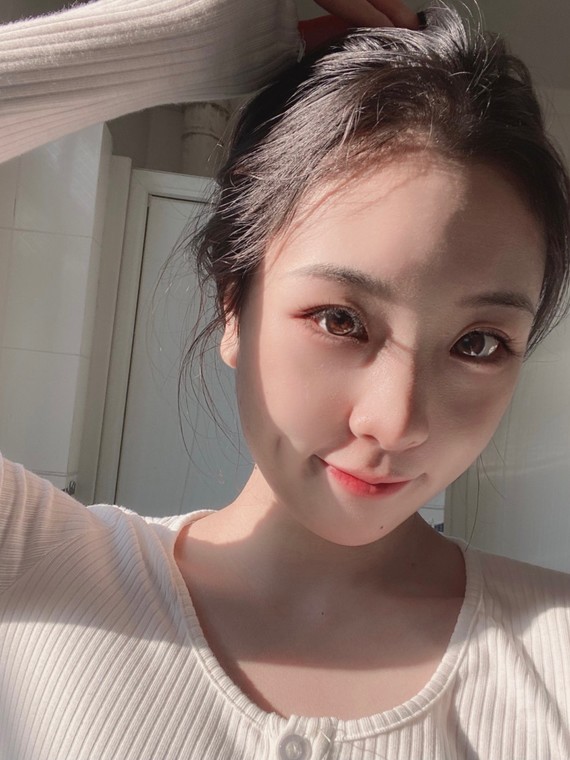 女孩25岁以后整个脸都下垂的好严重,我每次自拍都很_圈子-新氧美容