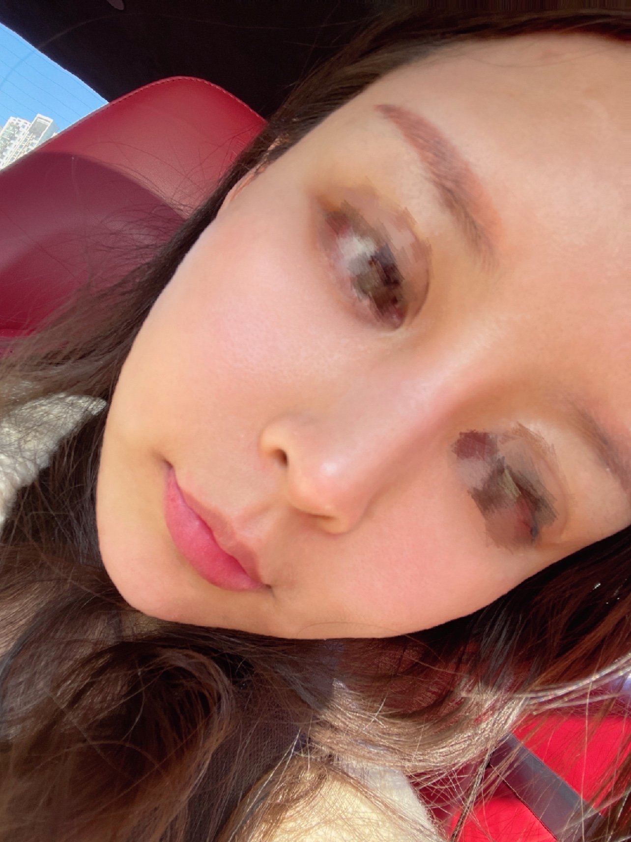 今天来更新塞洛丝汀胶原微针第二期啦0909