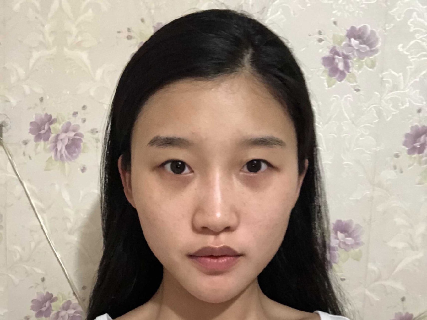 一直都是纯纯的单眼皮,加上熬夜追剧熬出来的黑眼圈眼_圈子-新氧美容